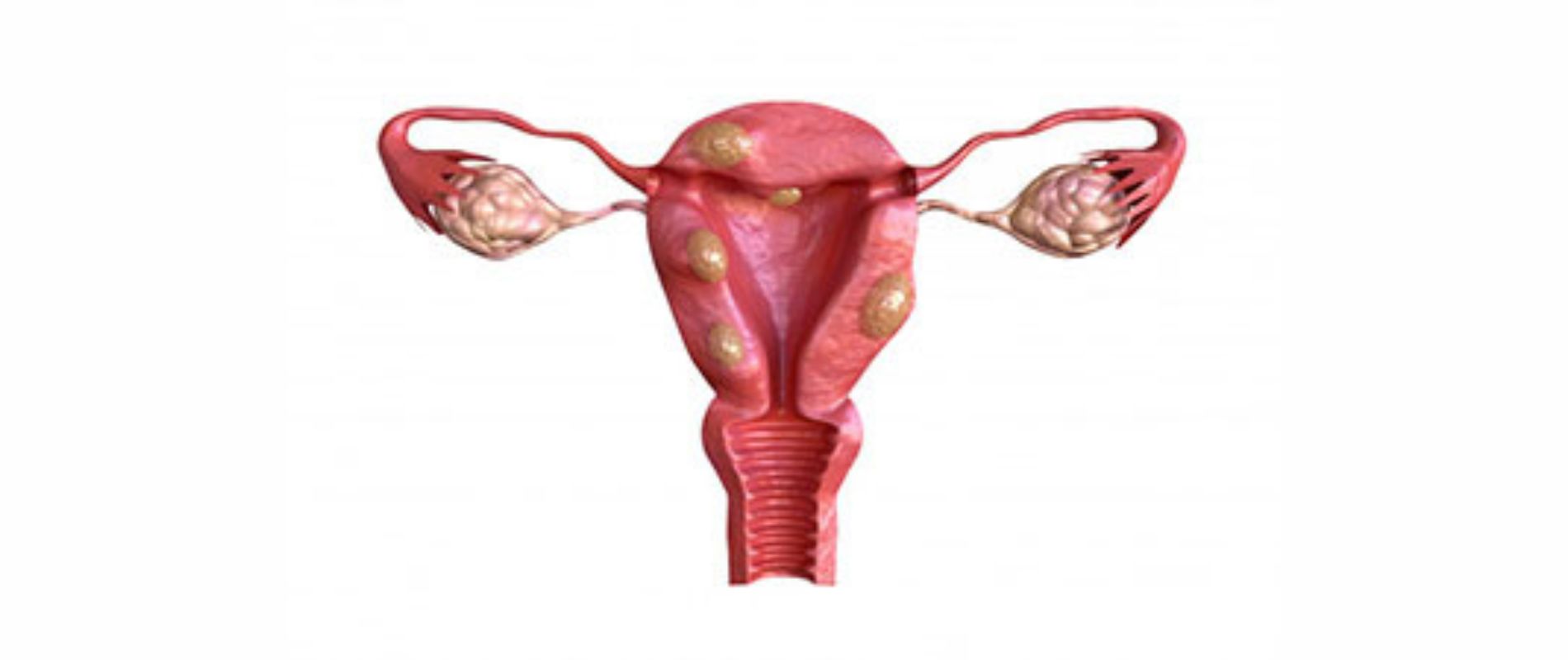 - Neelkanth IVF