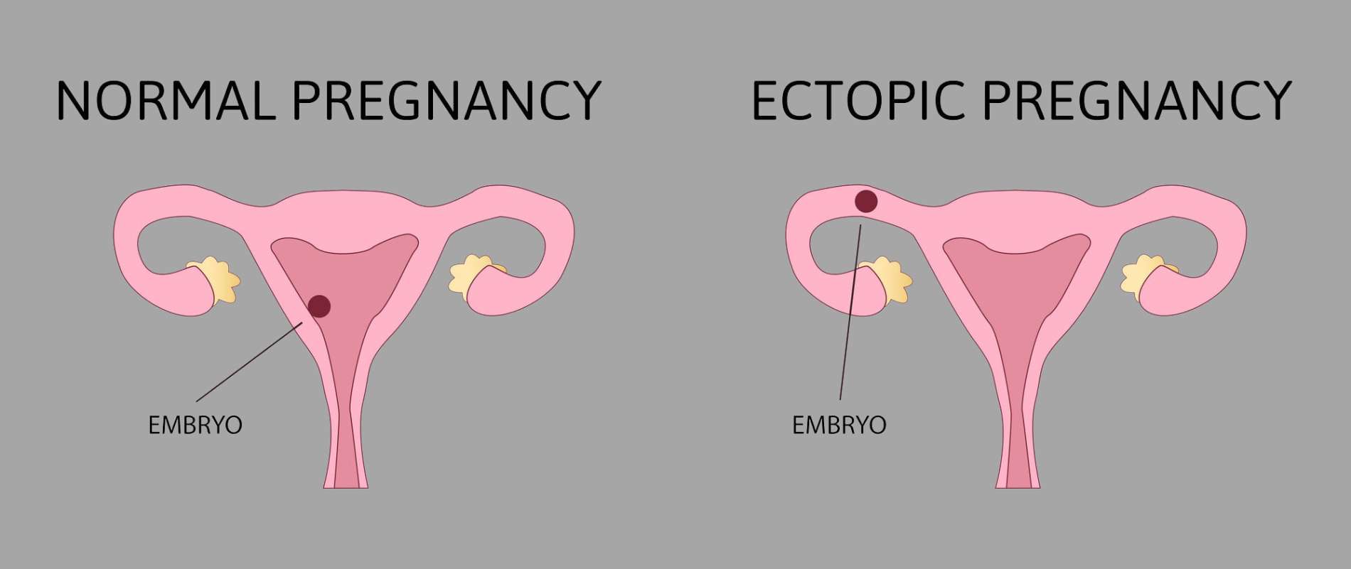  - Neelkanth IVF