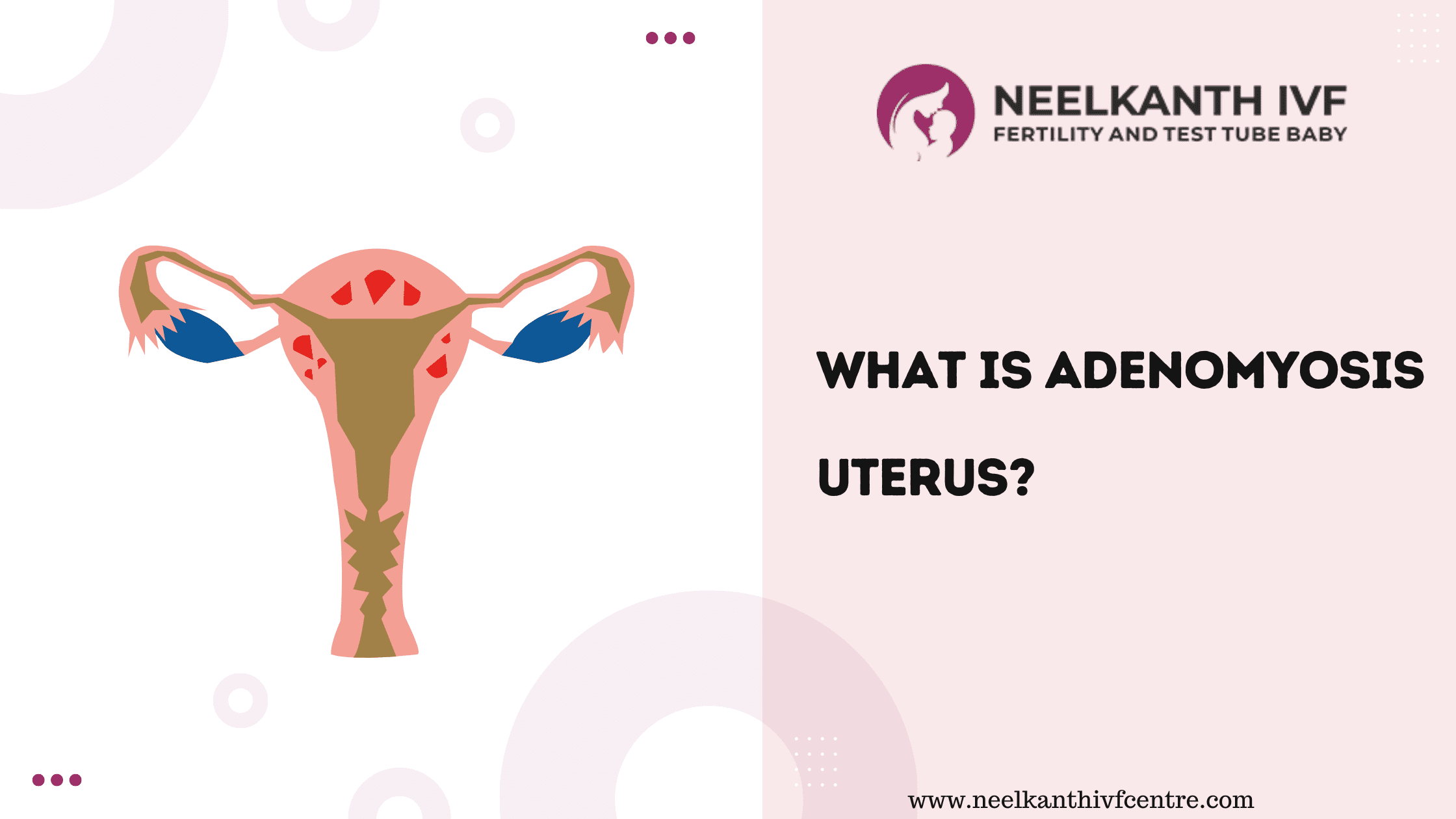  - Neelkanth IVF