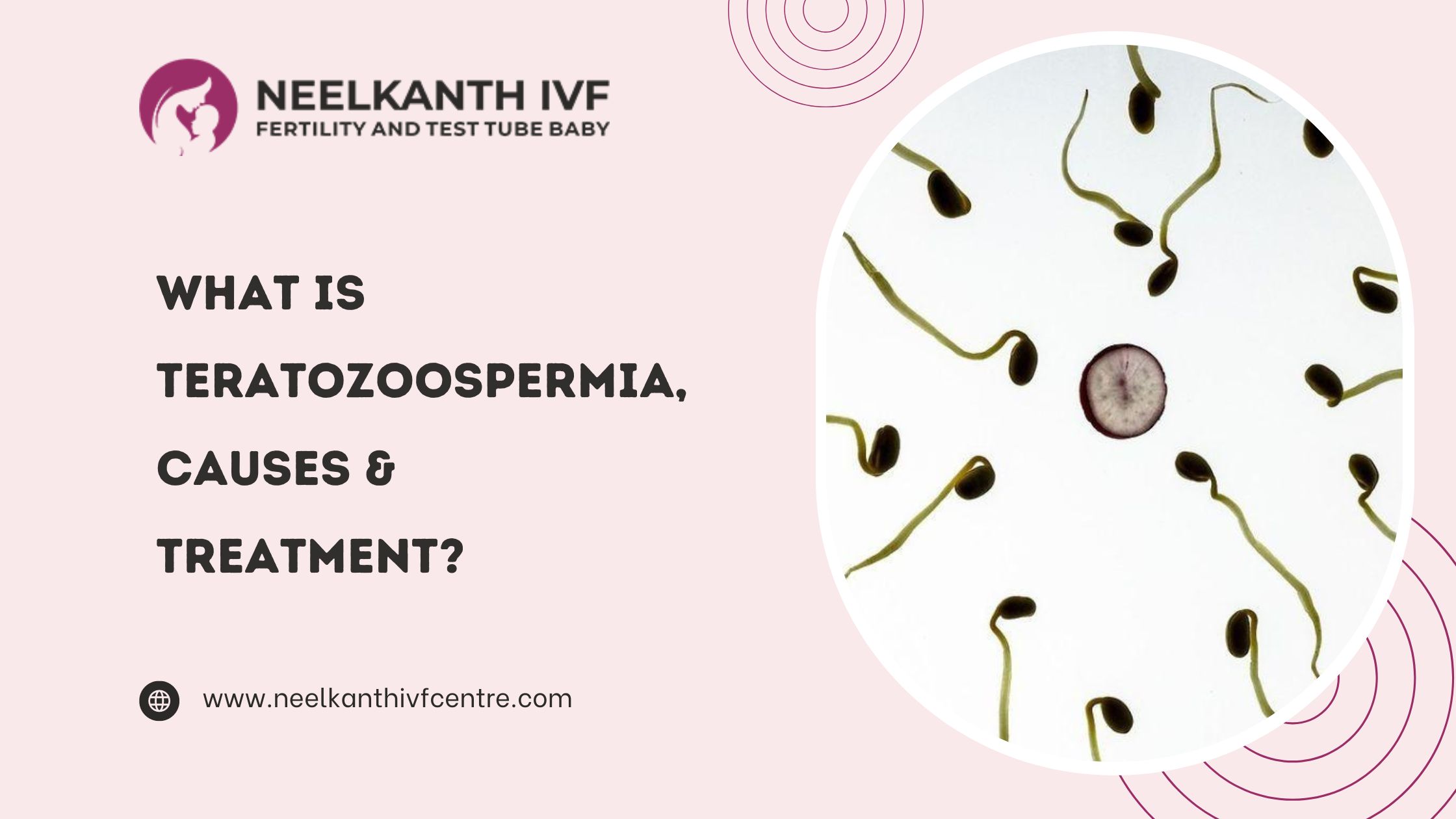 What is Teratozoospermia, Causes & Treatment? - Neelkanth IVF