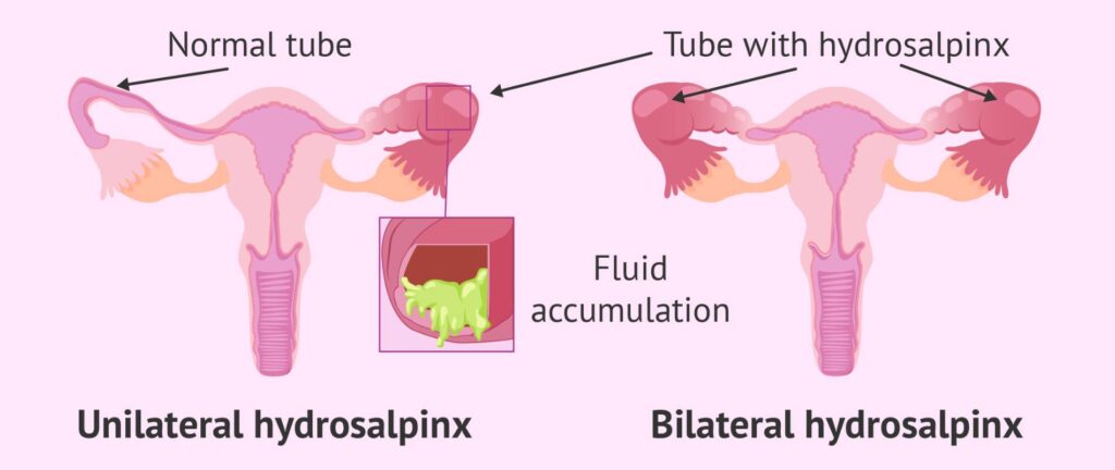  - Neelkanth IVF