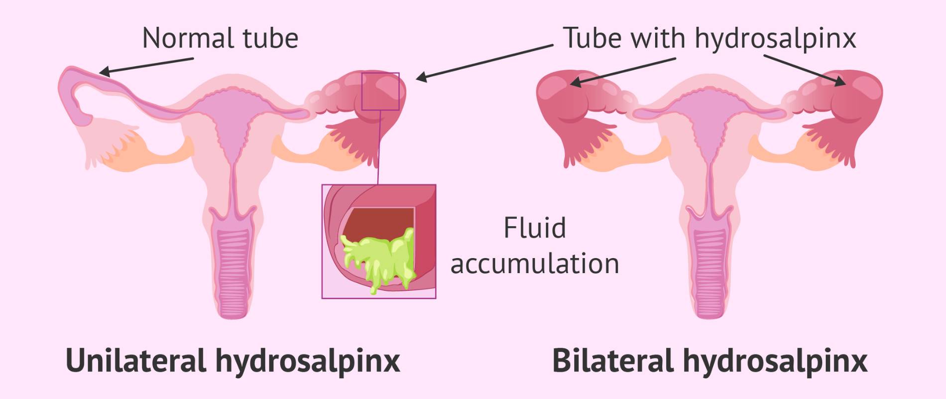  - Neelkanth IVF