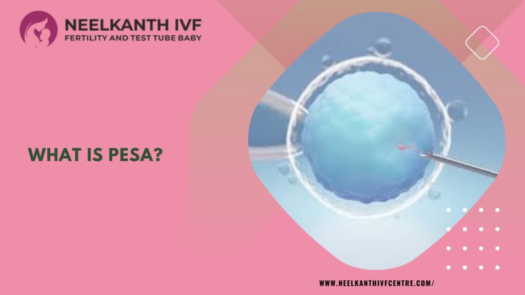 What is PESA?