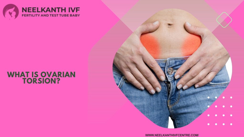 What Is Ovarian Torsion?