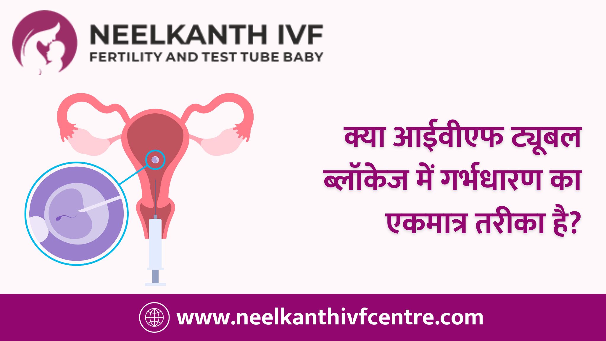 क्या आईवीएफ ट्यूबल ब्लॉकेज में गर्भधारण का एकमात्र तरीका है? - Neelkanth IVF