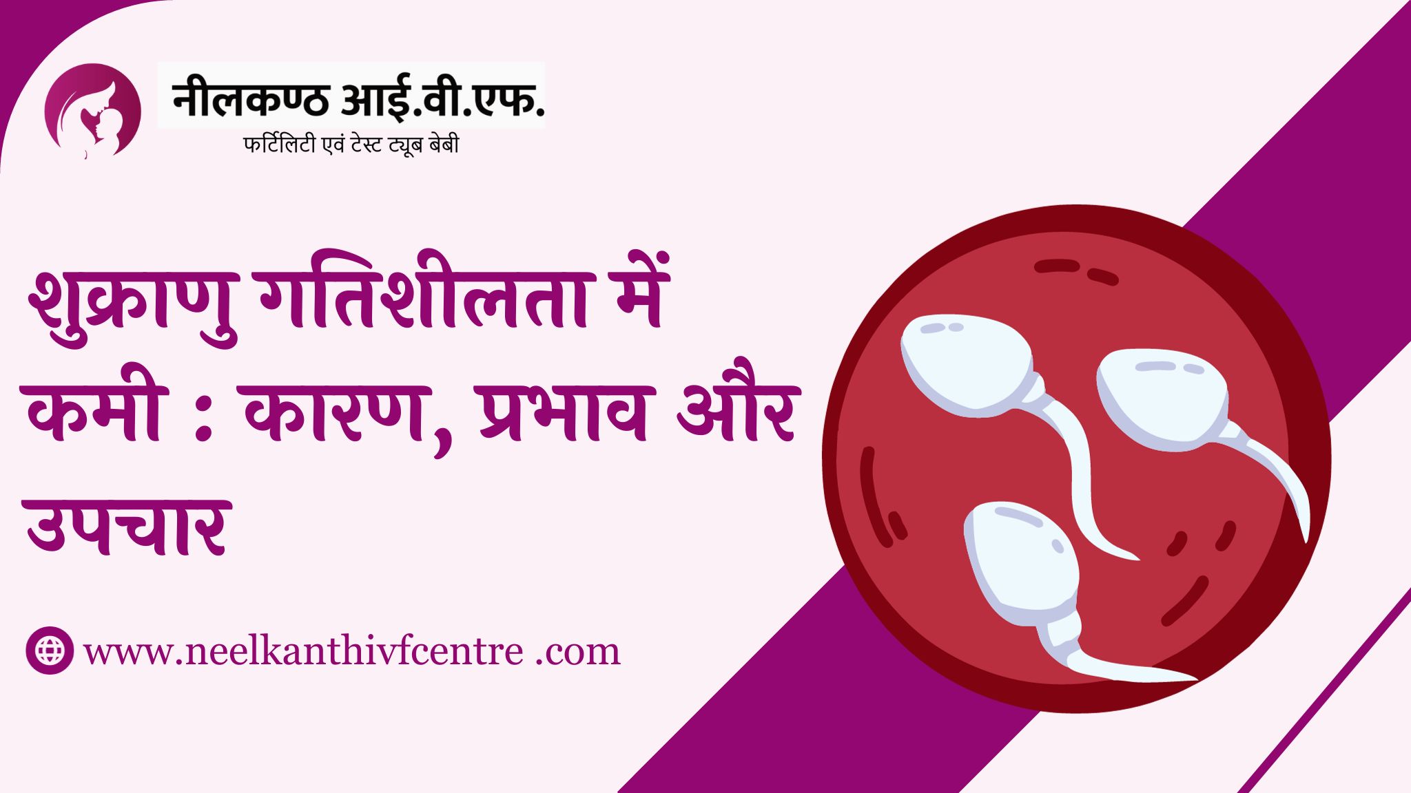 शुक्राणु गतिशीलता में कमी : कारण, प्रभाव और उपचार - Neelkanth IVF