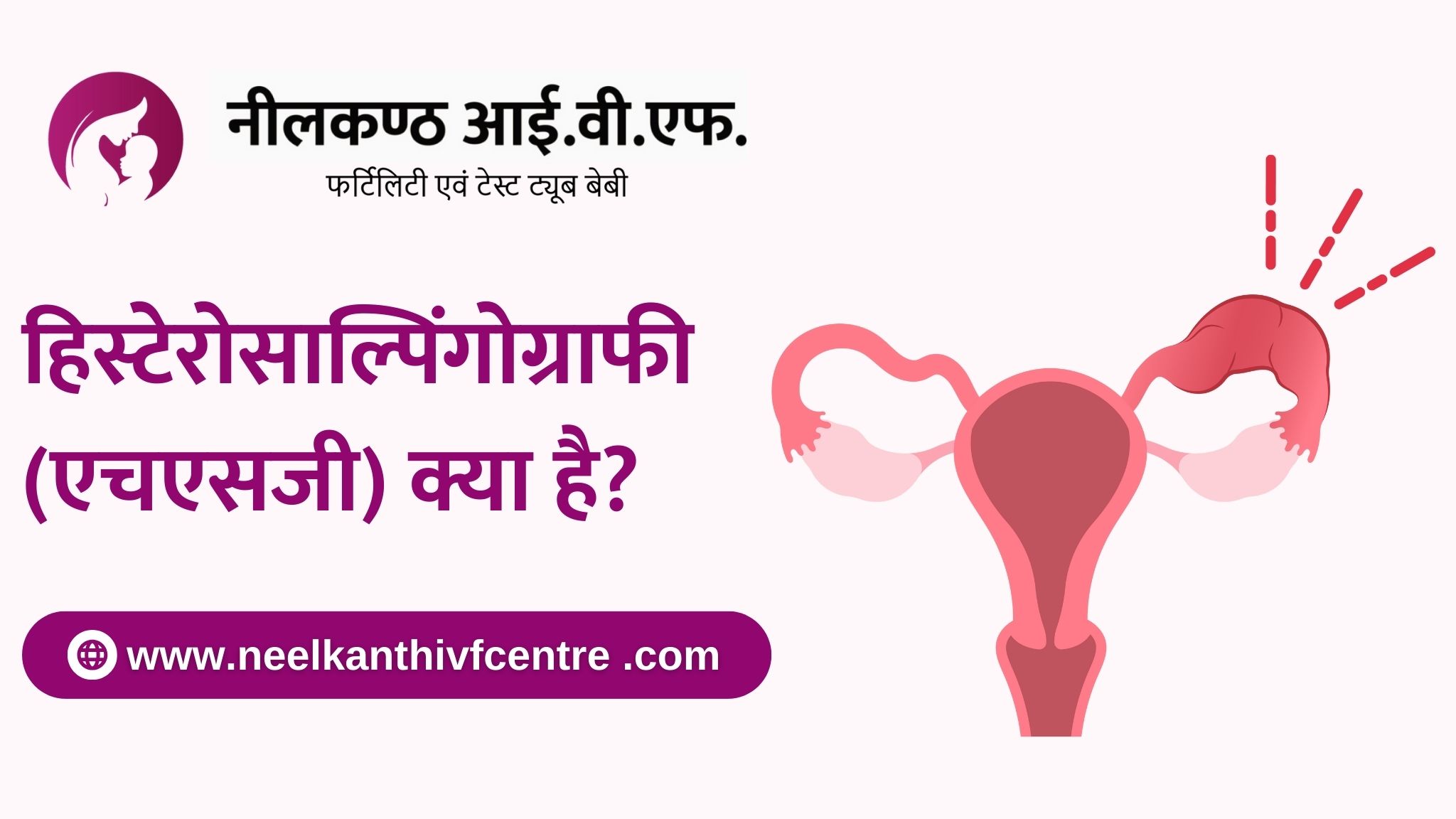 हिस्टेरोसाल्पिंगोग्राफी (एचएसजी) क्या है? - Neelkanth IVF