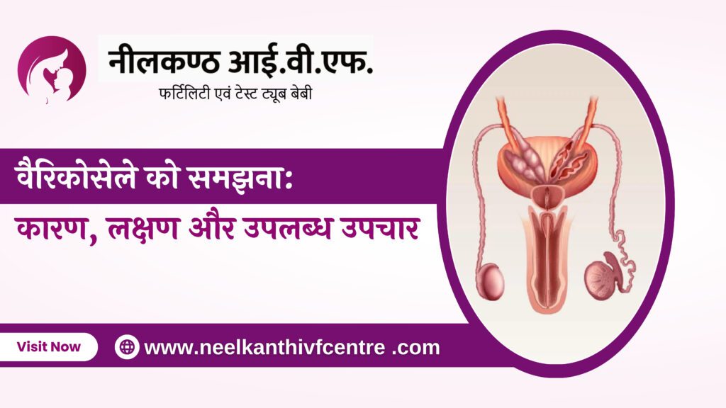 वैरिकोसेले को समझना: कारण, लक्षण और उपलब्ध उपचार