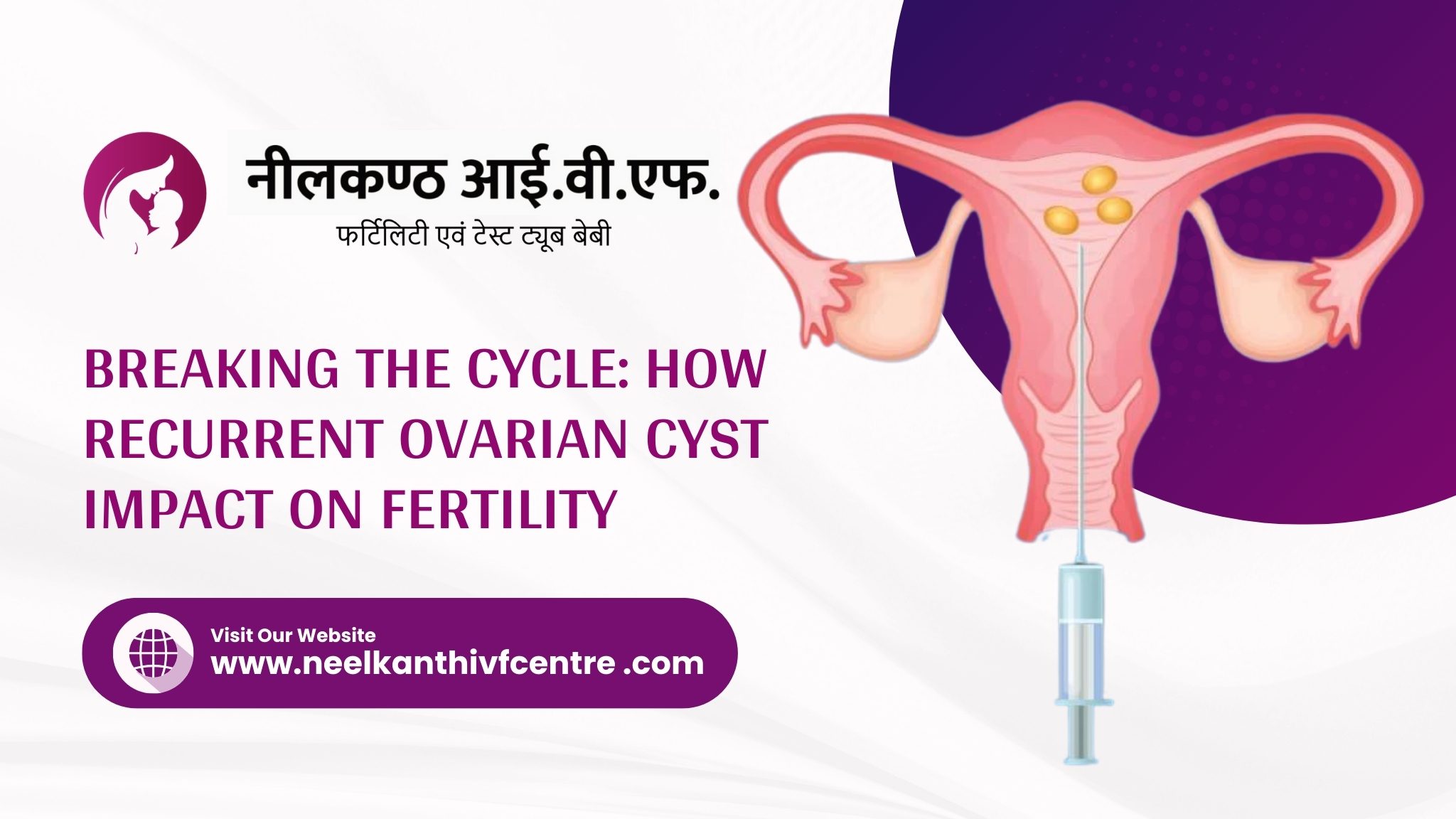 Breaking the Cycle: How Recurrent Ovarian Cyst Impact on Fertility - Neelkanth IVF