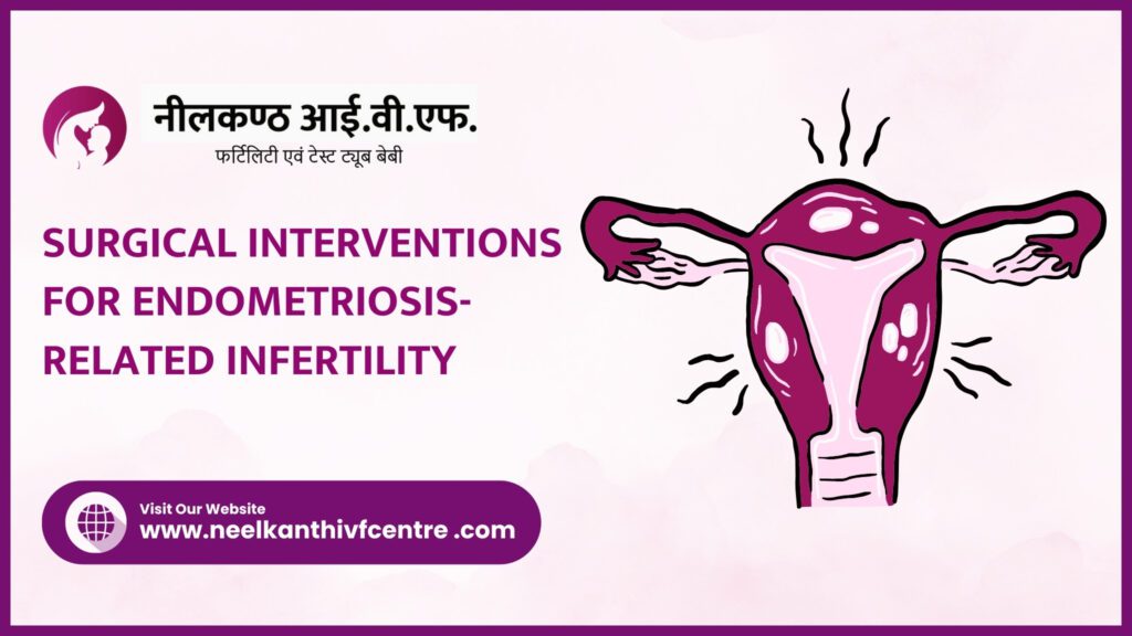 Surgical Interventions for Endometriosis-Related Infertility - Neelkanth IVF