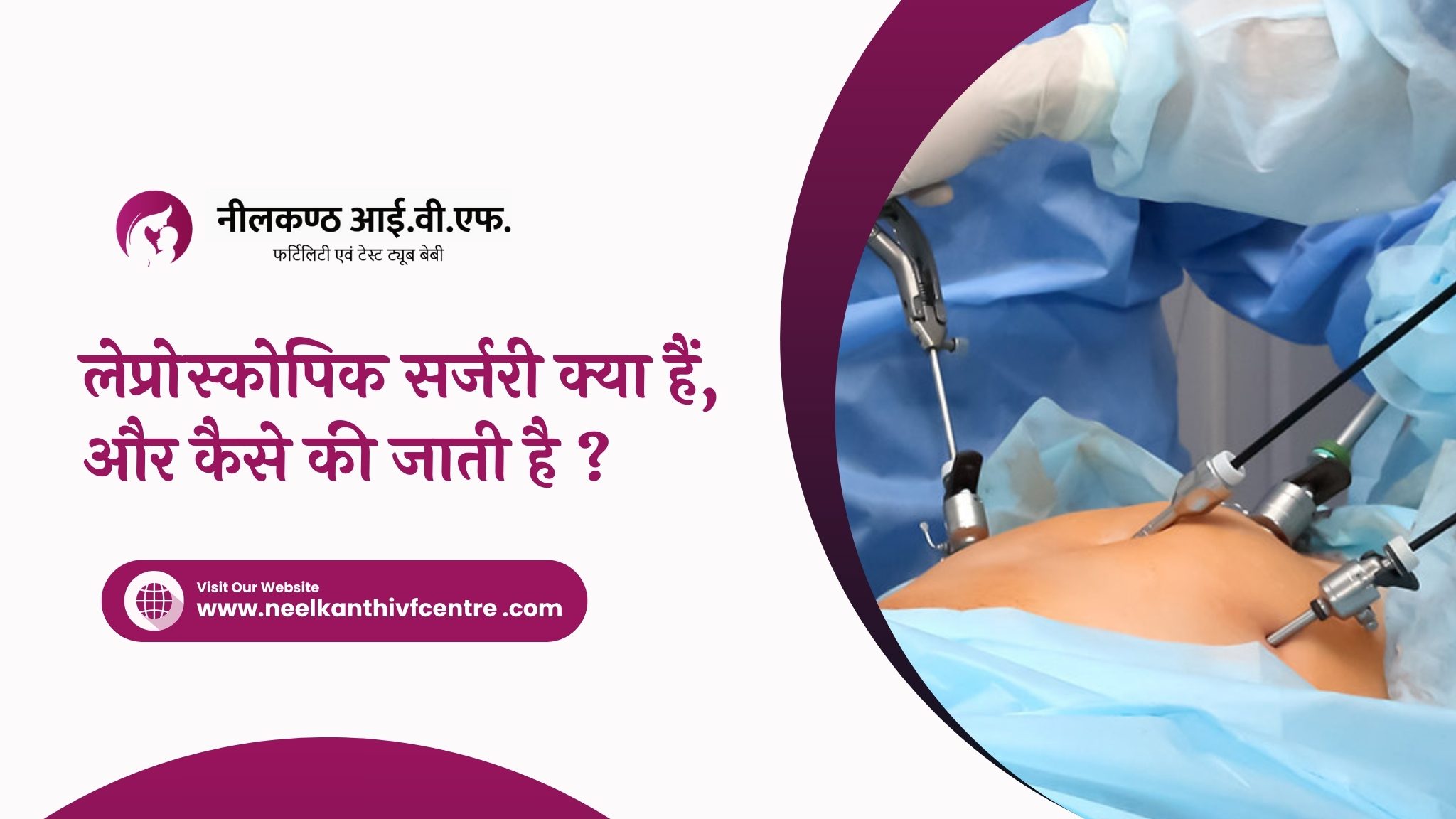 लेप्रोस्कोपिक सर्जरी क्या हैं, और कैसे की जाती है ? - Neelkanth IVF