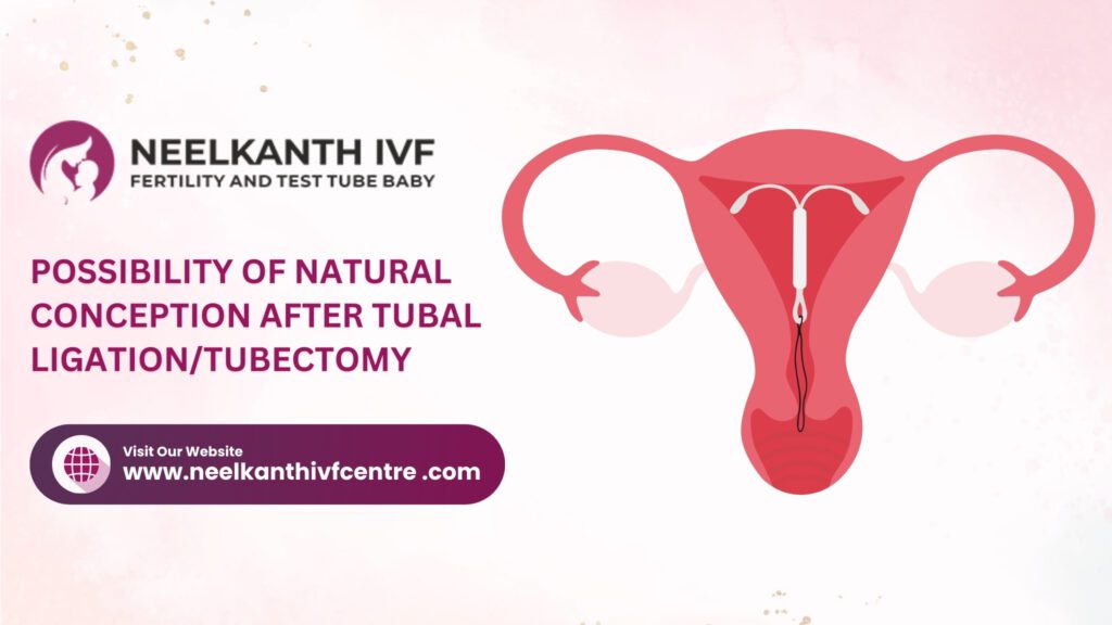Possibility Of Natural Conception After Tubal Ligation/Tubectomy - Neelkanth IVF
