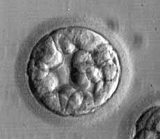  - Neelkanth IVF
