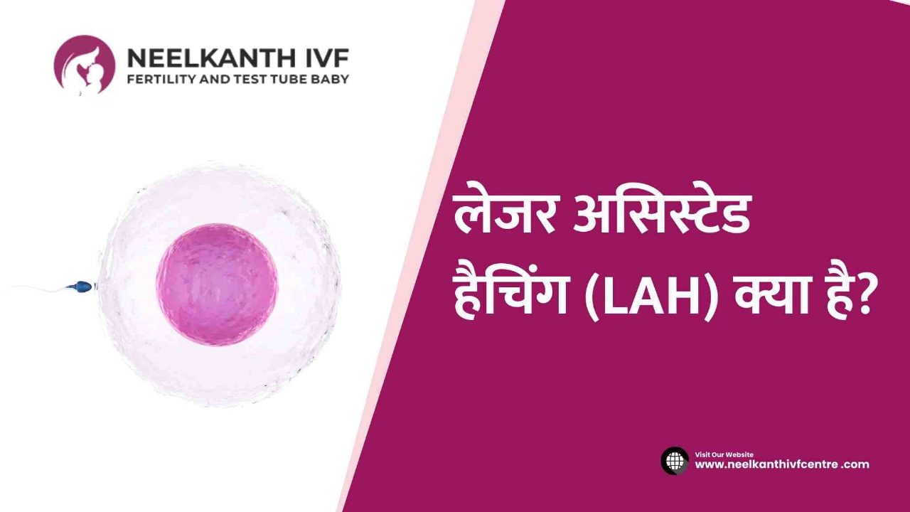Laser Assisted Hatching - Neelkanth IVF