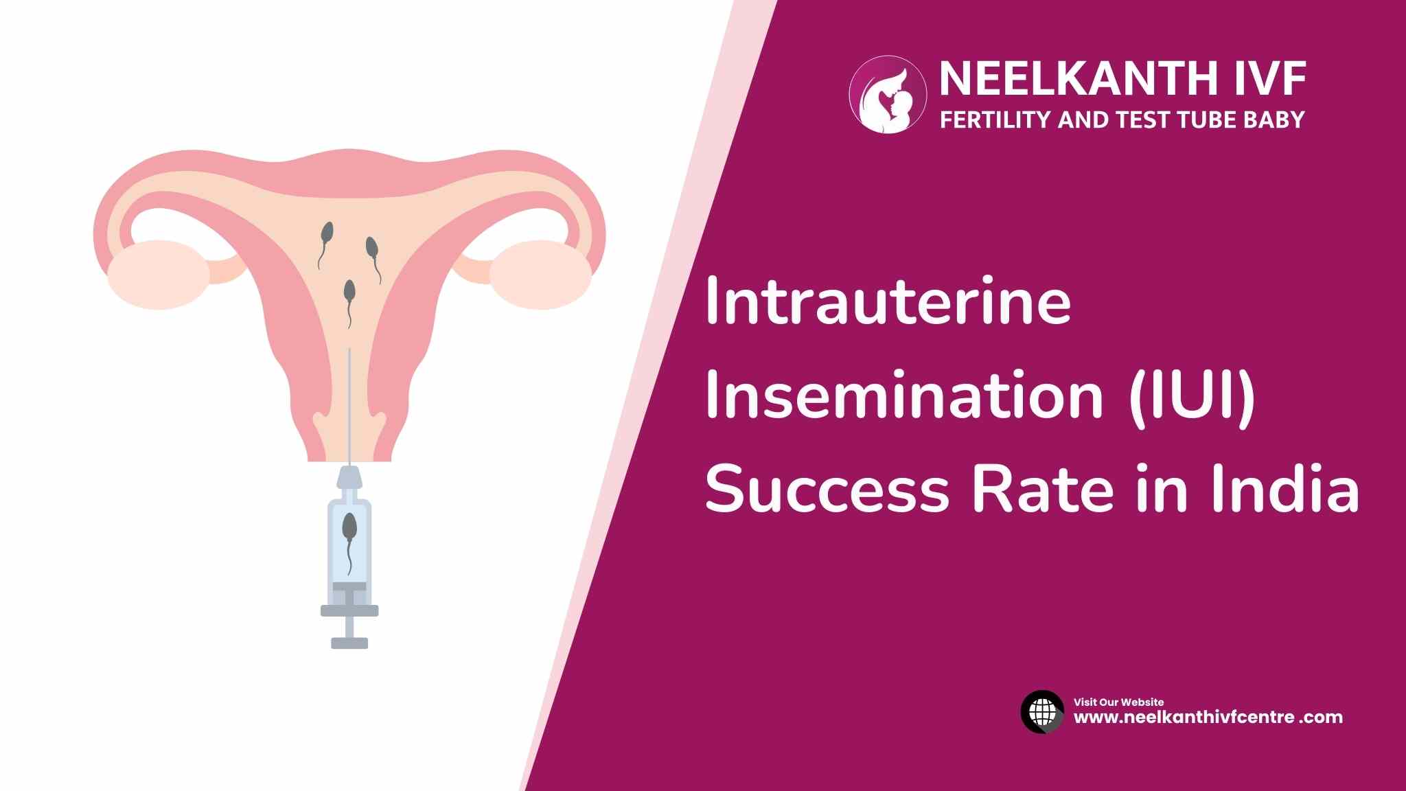 Intrauterine Insemination (IUI) Success Rate in India - Neelkanth IVF