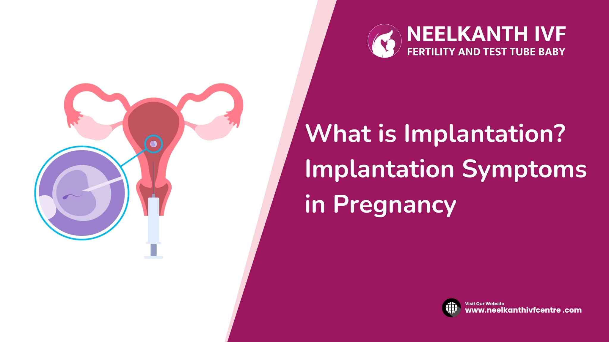 What is implantation? Implantation Symptoms in Pregnancy - Neelkanth IVF