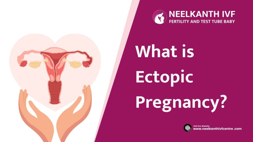 Ectopic Pregnancy - Neelkanth IVF