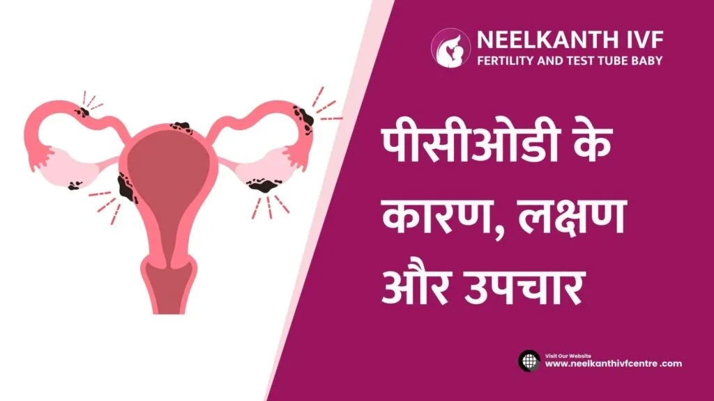 PCOD in Hindi - Neelkanth IVF