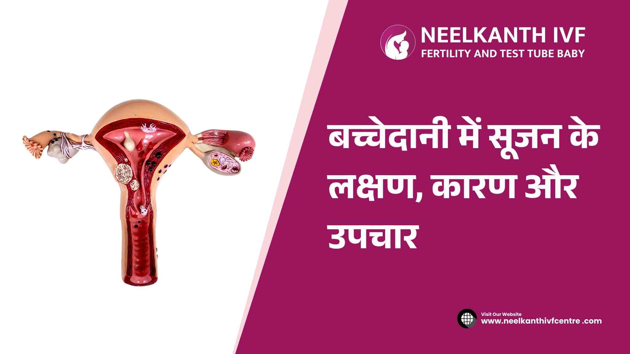 बच्चेदानी में सूजन (Bachedani Me Sujan) के लक्षण, कारण और उपचार - Neelkanth IVF
