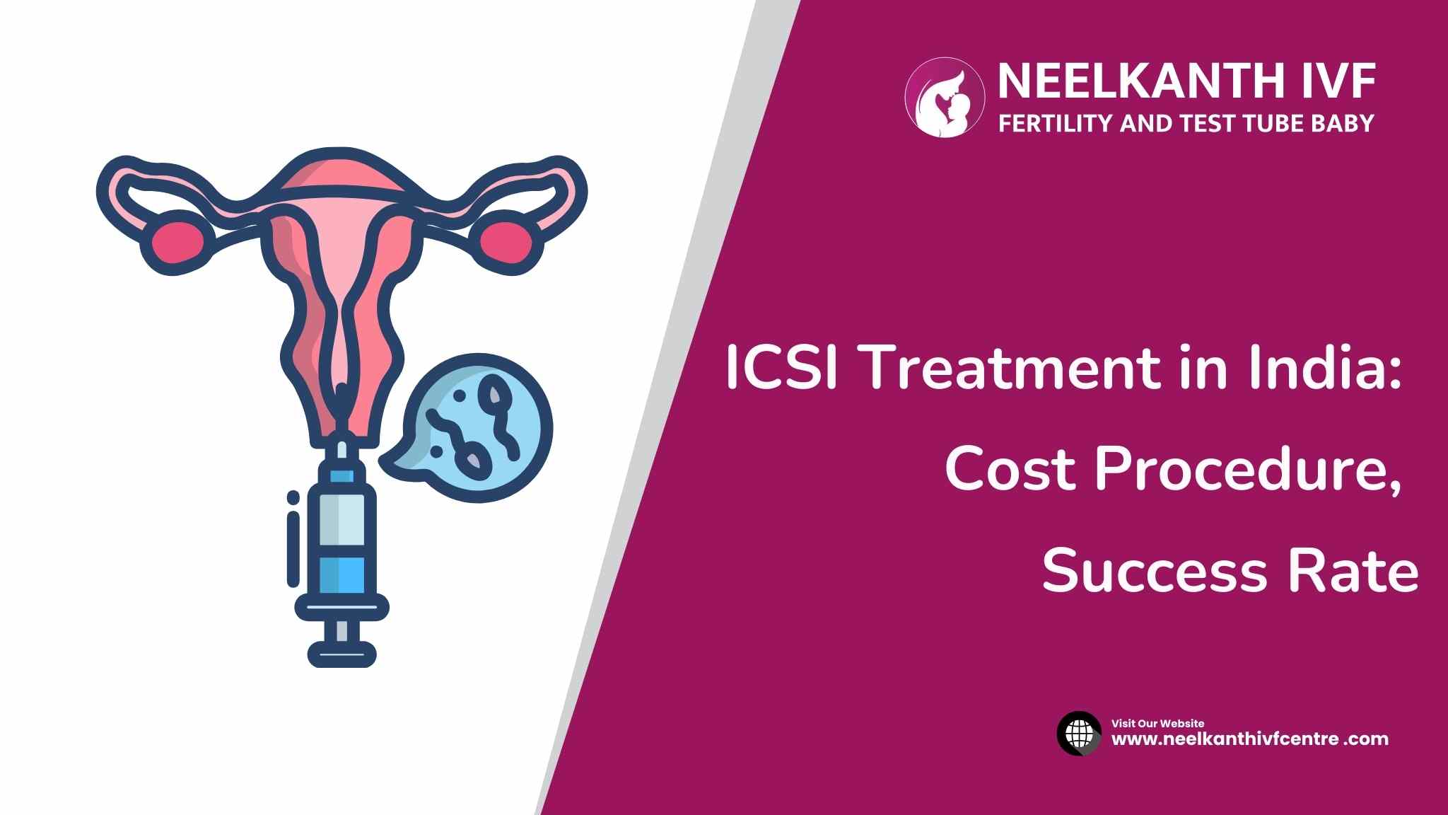 ICSI Treatment in India - Neelkanth IVF