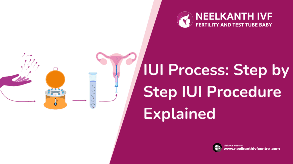 IUI Process: Step by Step IUI Procedure Explained - Neelkanth IVF