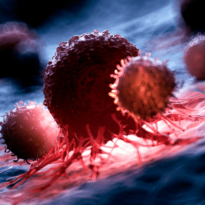 Male Infertility