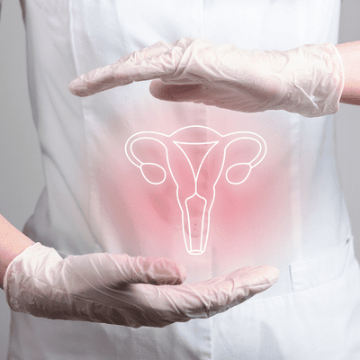 PCOS