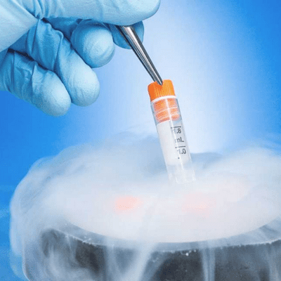 Sperm Freezing