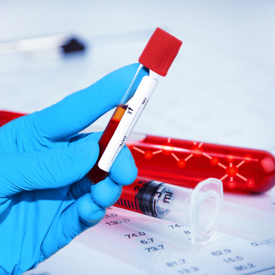 DNA Fragmentation Test